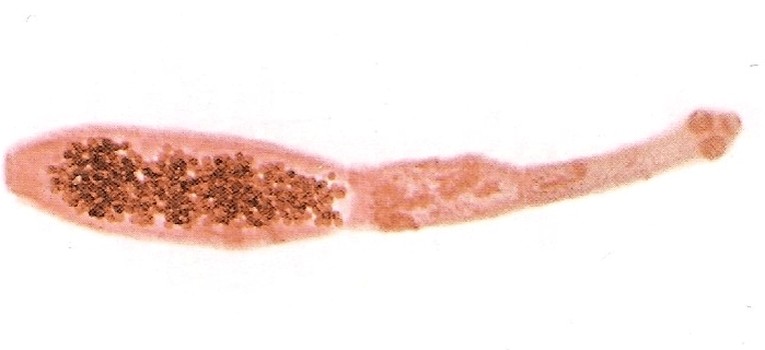 Echinococus