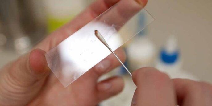 Larruazala parasitoak