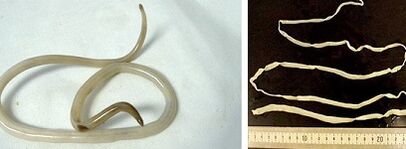 parasito motak giza gorputzean