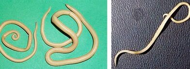 zer parasito izan ditzake pertsona batek